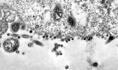 Incidência de SRAG parou de cair e pode voltar a crescer, diz Fiocruz