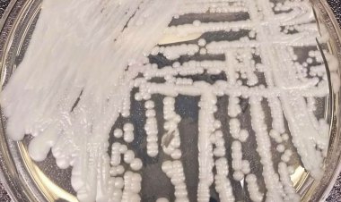 Entenda por que a Candida auris foi apelidada de superfungo