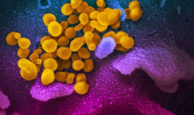 Covid-19: estudo aponta aumento de bactérias resistentes em UTIs