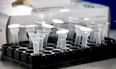 Rio de Janeiro começa a desmobilizar postos de testagem de covid-19