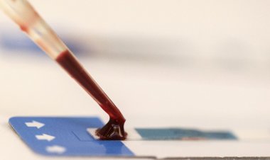 Metrô de São Paulo faz ação de combate ao HIV