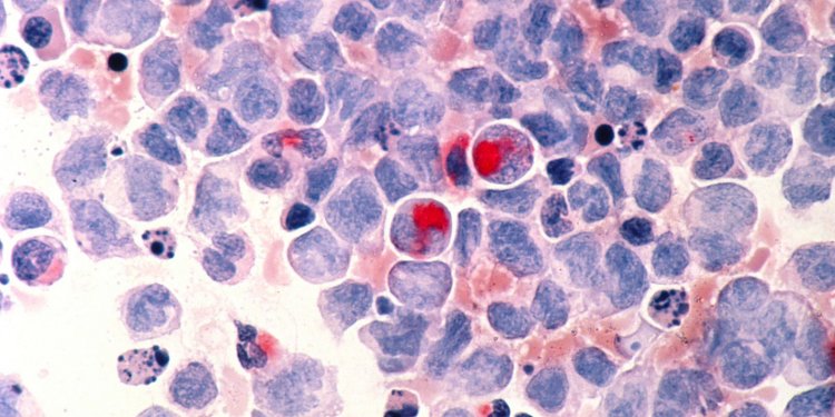 Anvisa aprova primeira terapia gênica contra câncer no Brasil