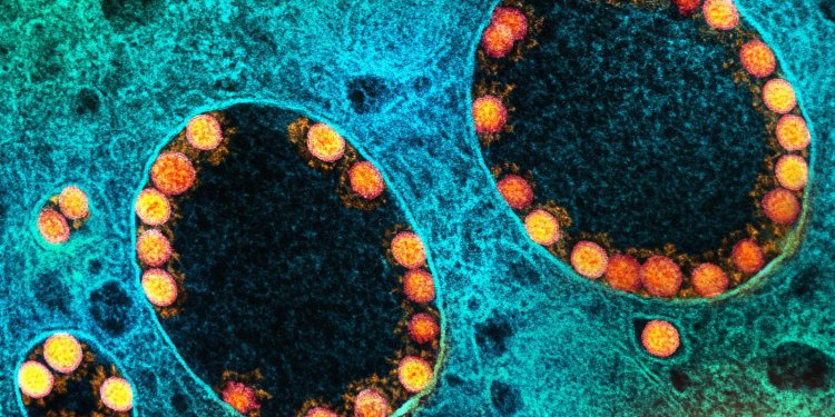 Covid-19: estudo mostra sucesso de inibidores de enzimas no tratamento