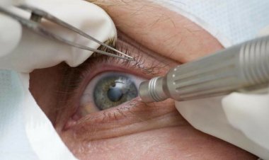 Guia tenta evitar expansão de casos de cegueira por glaucoma