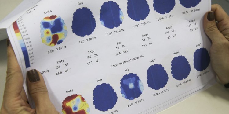 Março Roxo quer conscientizar população sobre a epilepsia