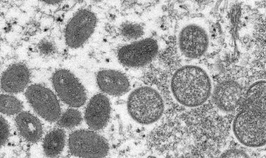 Varíola dos macacos: governador paulista não vê motivo para pânico