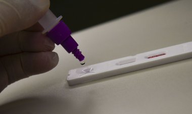 Fiocruz: casos de síndrome respiratória grave atingem patamar estável