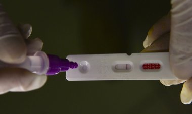 Covid-19: Brasil notifica 365 óbitos e 72 mil casos em 24 horas