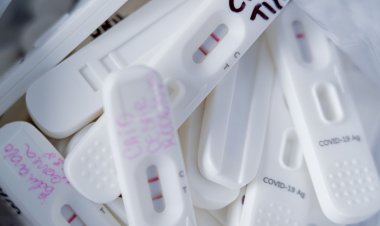 Covid-19: Brasil tem 16,6 mil novos casos e 36 mortes em 24 horas