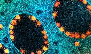 Brasil registra 57,9 mil novos casos e 353 óbitos por covid-19