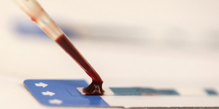 Paciente é declarado curado do HIV após receber células-tronco