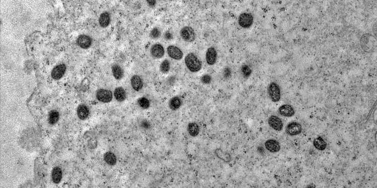 Rio confirma primeiro caso de varíola de macacos em unidade prisional