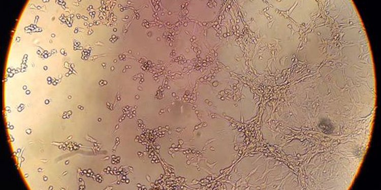 Rio registra segunda morte de infectado pela varíola dos macacos