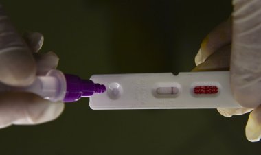 Casos de covid-19 no Rio de Janeiro aumentam 430% em uma semana