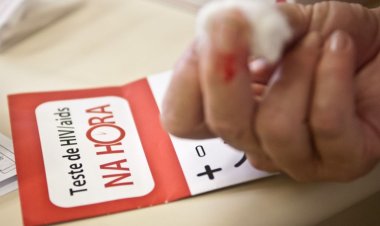 Projeto PrEP na Rua inicia atividades no Minhocão, em São Paulo