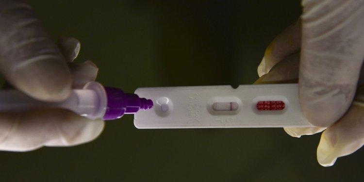 Hospitalizações por covid-19 mantêm tendência de alta nos estados